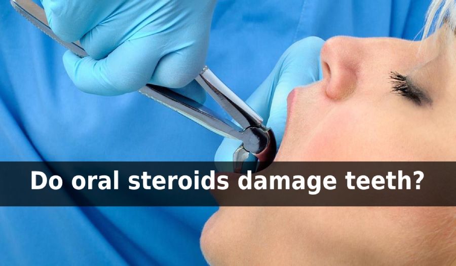 steroids for wisdom teeth removal side effects